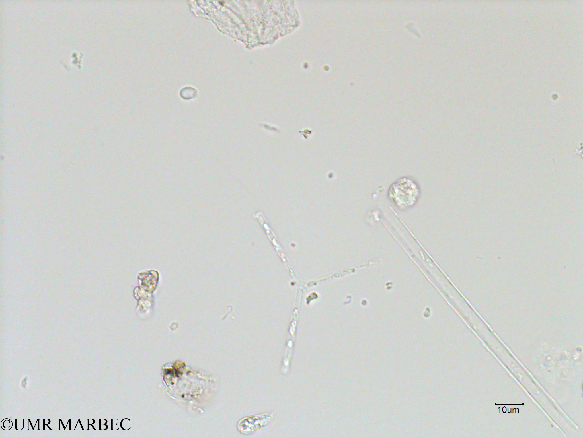 phyto/French_Polynesia/Arutua/ECOPE Janvier 2017/Thalassionema sp3 cf nitzschioides (sp1 -C1A_S1R2_050117).tif(copy).jpg